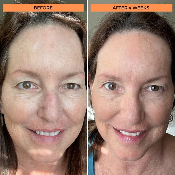 NWOB BeautyStat Universal C Skin Refiner All Skins Full Size 1 fl oz / 30 ml - Picture 13 of 13